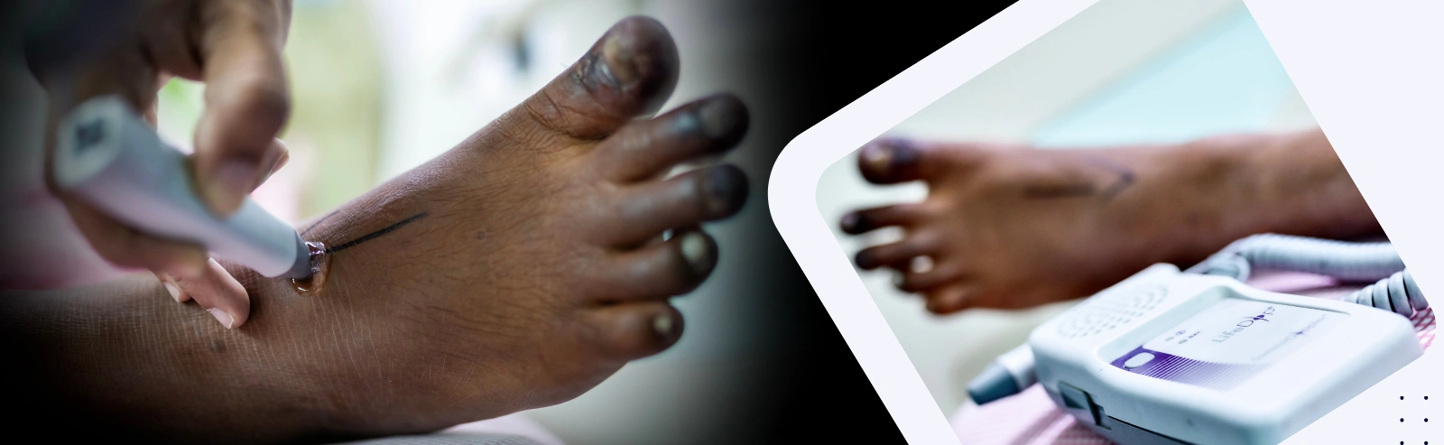 diabetic information